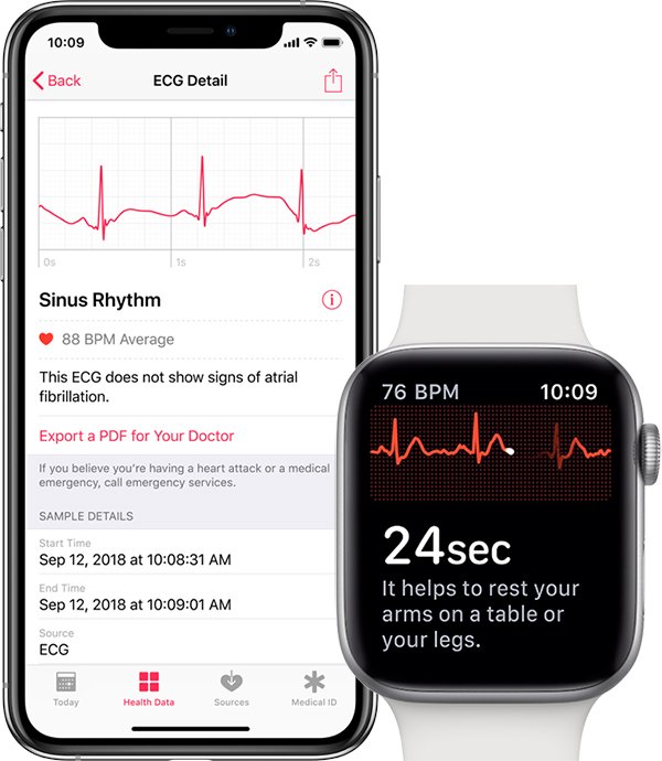 apple-watch-ecg-readings