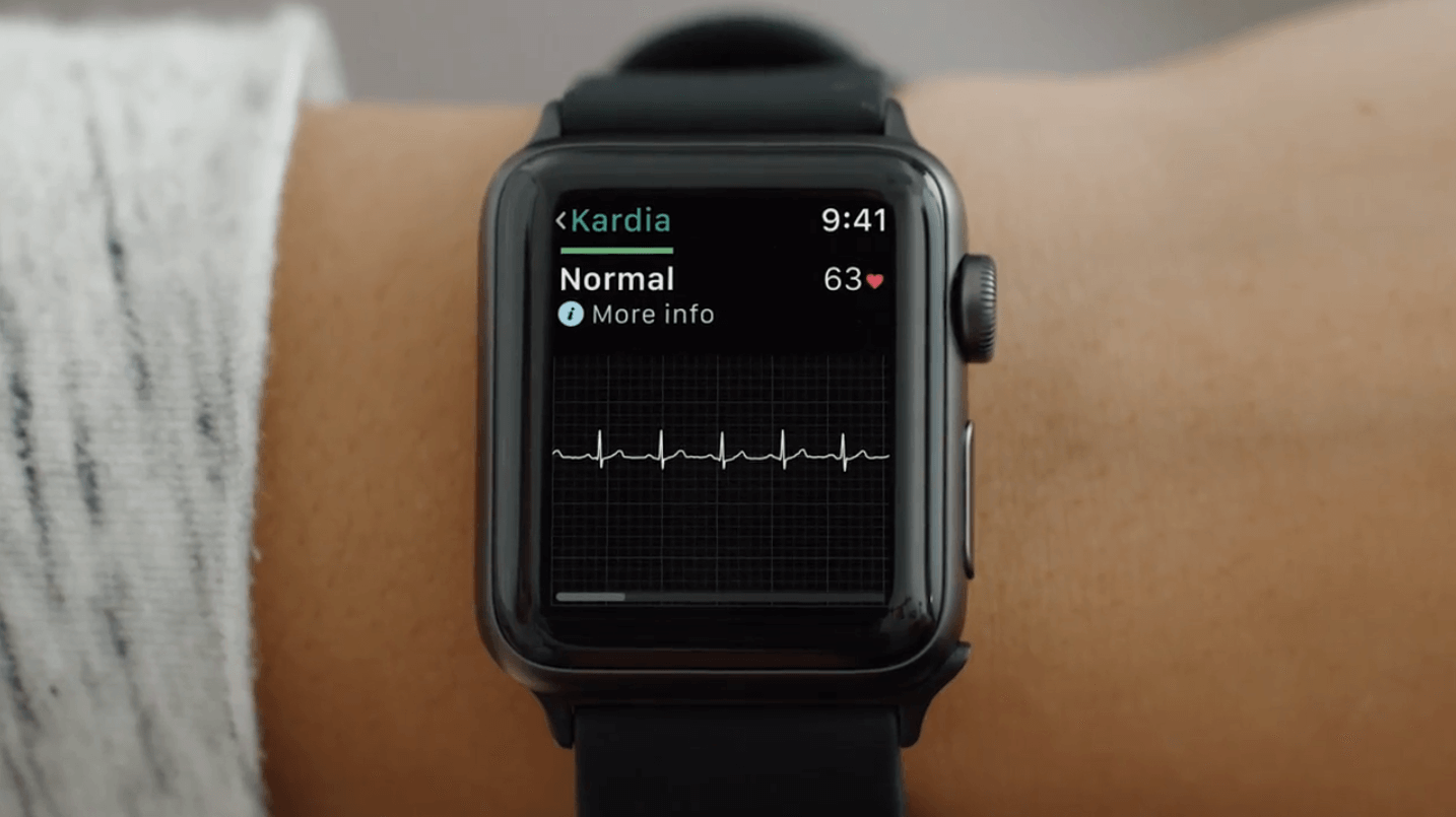 Apple Watch Cardiogram